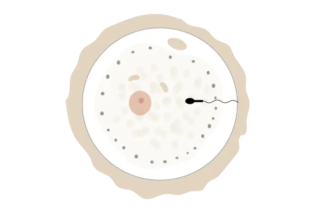 Service · IVF with donor sperm illustration