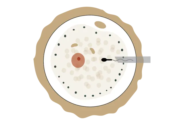 Service · IVF with ICSI illustration