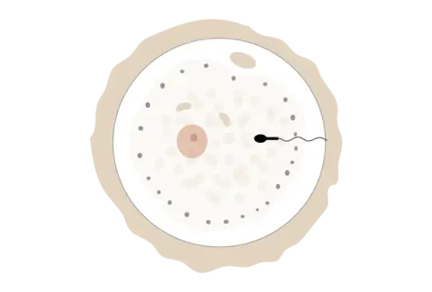 Service · IVF with donor sperm illustration