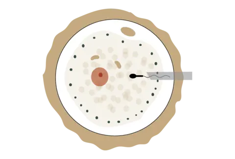 Service · IVF with ICSI illustration